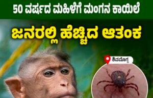 ಹೊಸನಗರ ತಾಲೂಕಿನ ಮಹಿಳೆಗೆ ದೃಢವಾದ ಮಂಗನ ಕಾಯಿಲೆ…!!